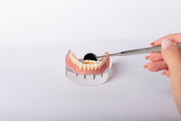 Reasons To Consider All On  ® Teeth Replacement