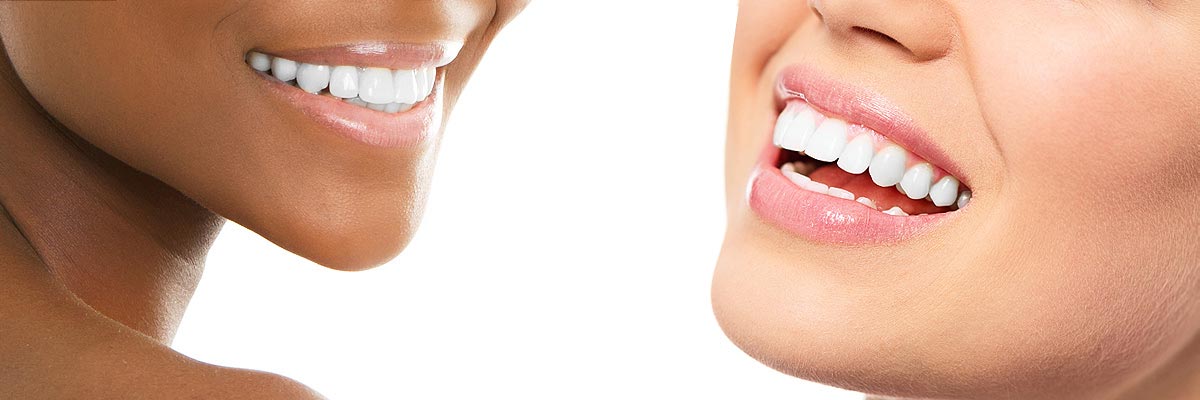 Teeth Whitening Chicago Il Tooth Bleaching Dentist